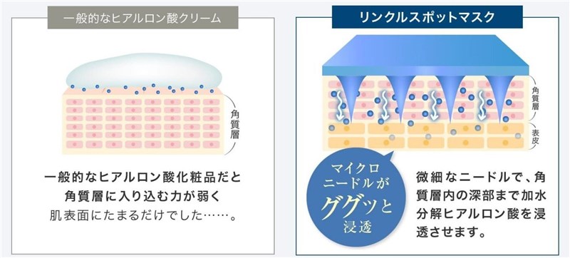 リンクルスポットマスクのマイクロニードルでヒアルロン酸を角質層まで届ける